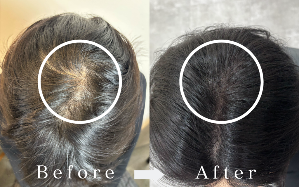 Tokyo Azabu-Juban salon - Scalp Ink - thinning hair - aging hair - scalp art makeup